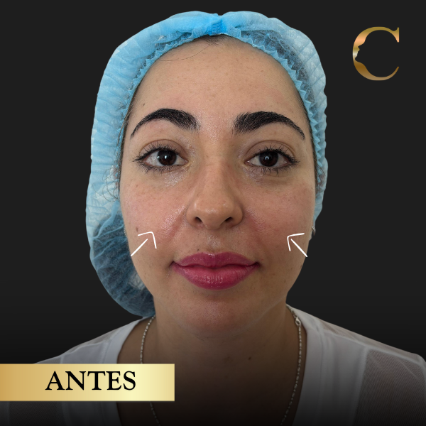 Fullface Antes 2 (2)