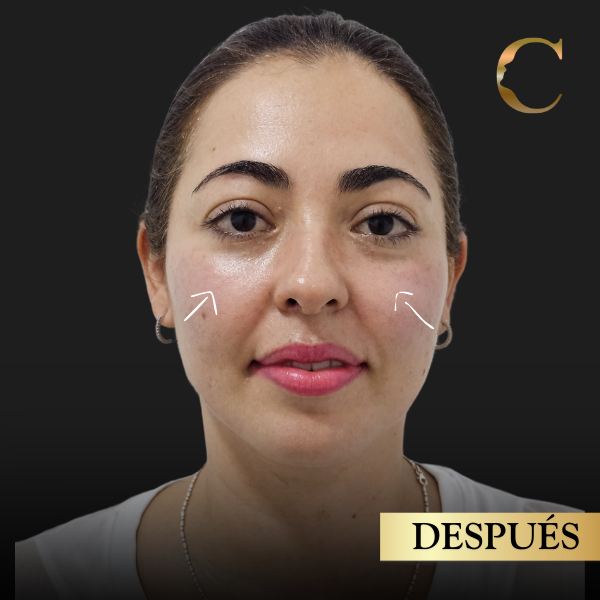 Fullface Antes 2 (4)